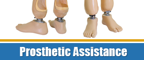Prosthetic Assistance